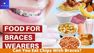 Can You Eat Chips With Braces?